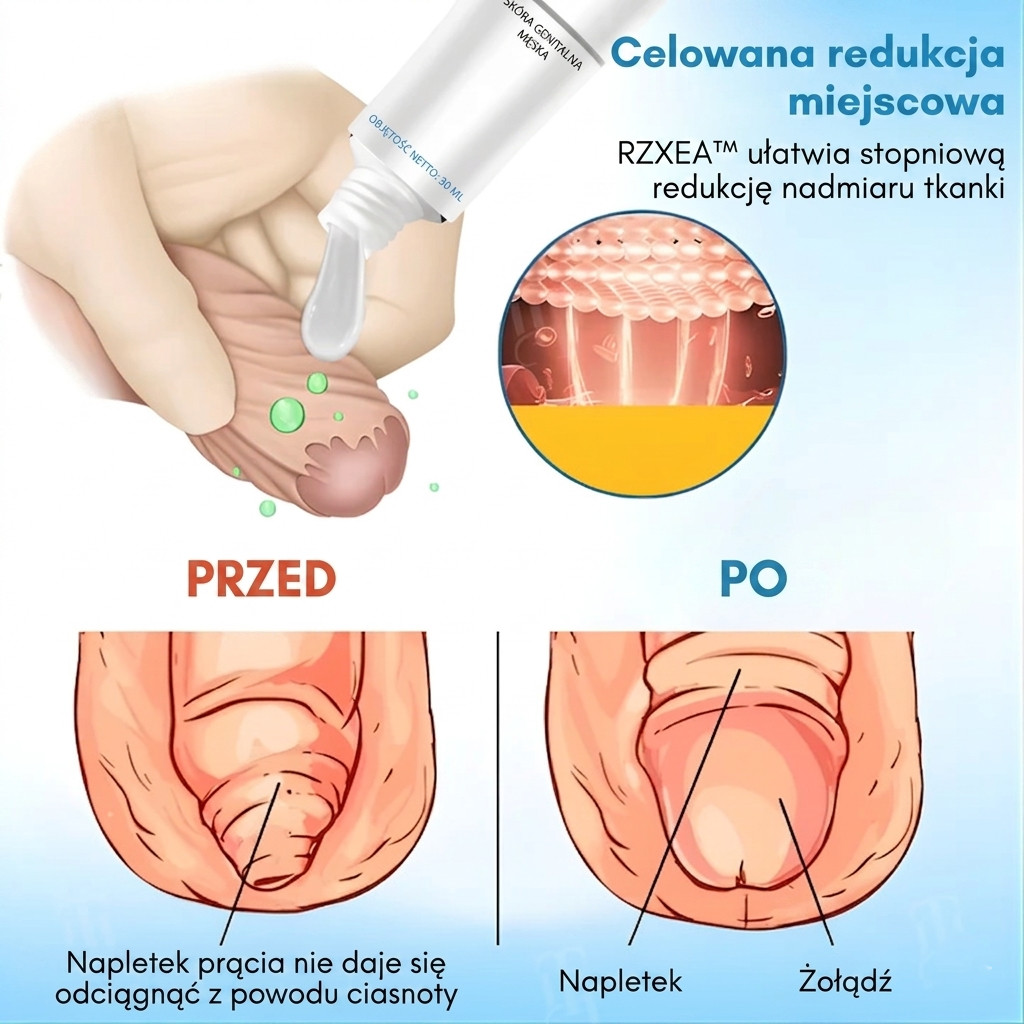 RZXEA™ Elastyczność Napletka Zel