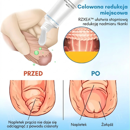 RZXEA™ Elastyczność Napletka Zel