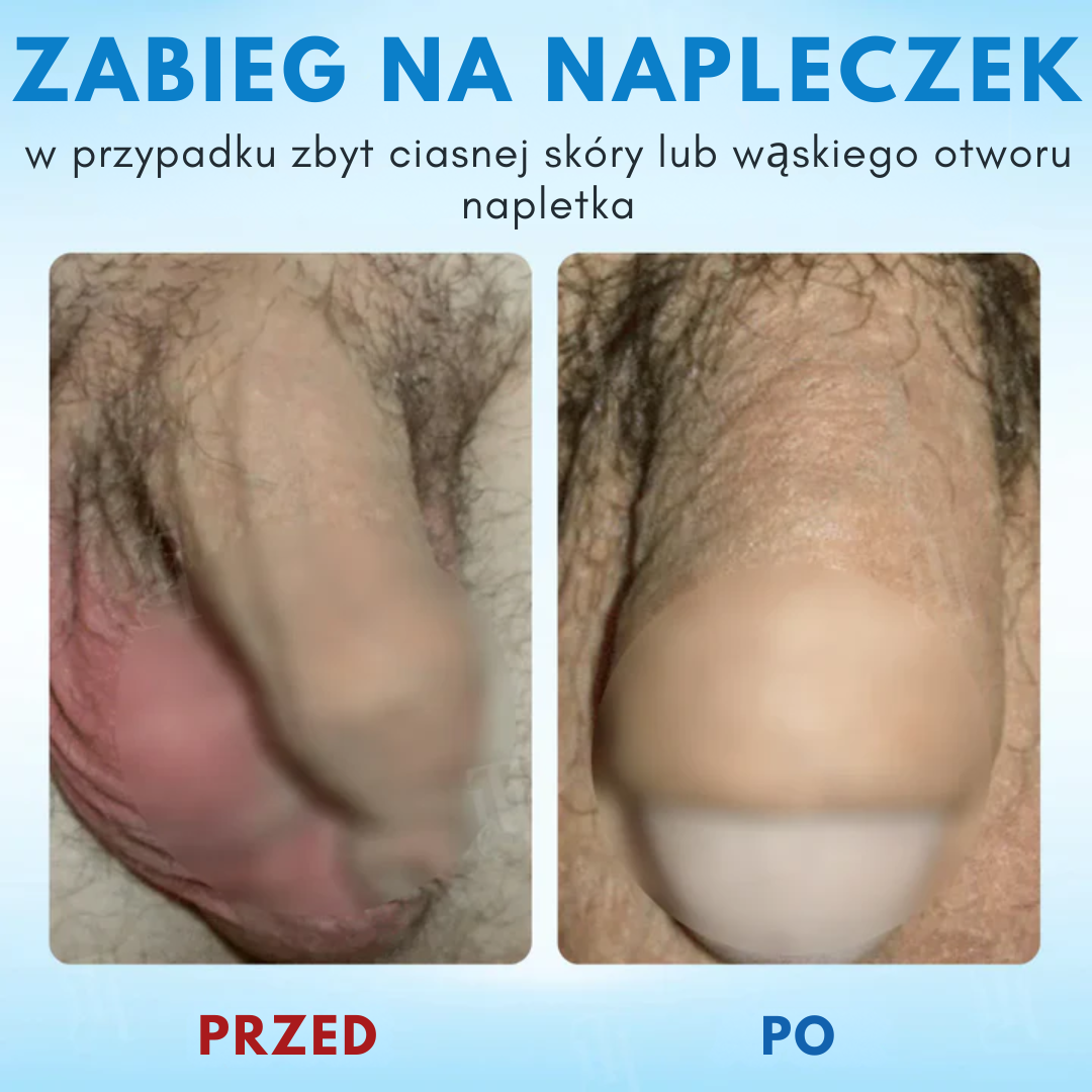 RZXEA™ Elastyczność Napletka Zel